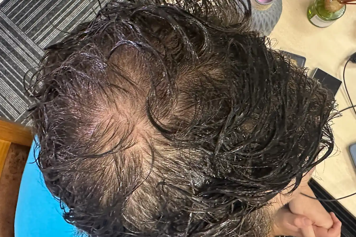 After treatment, result 04