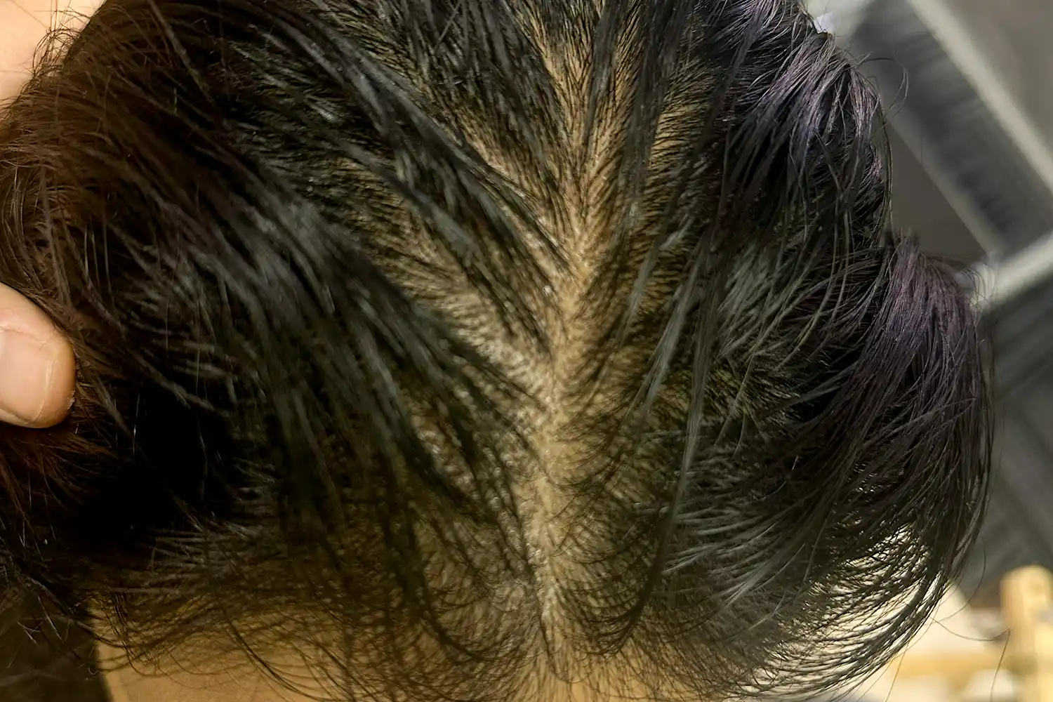 After treatment, result 05