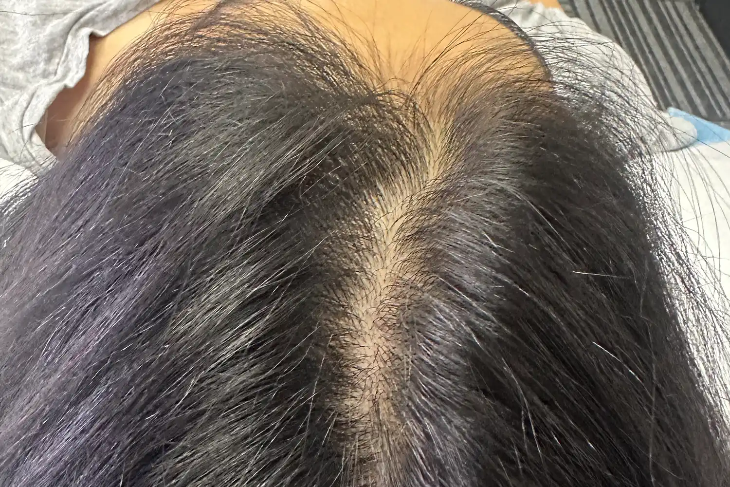 After treatment, result 06
