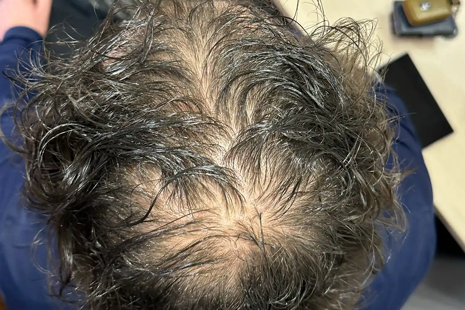 Before treatment, result 04