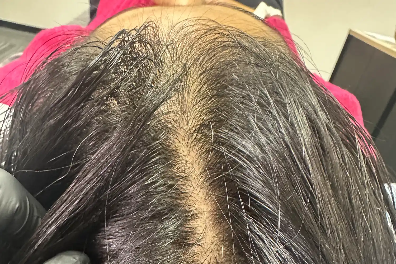 Before treatment, result 06