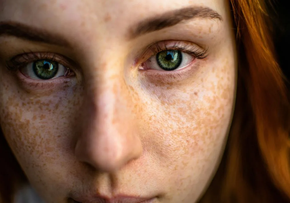 Sun Damaged Skin
